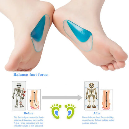 Silicone Orthopedic Insoles Flat Foot Arch Support Insert Pad Corrector Shoe Cushion Gel Valgus Correction Plantar Fasciitis Pad